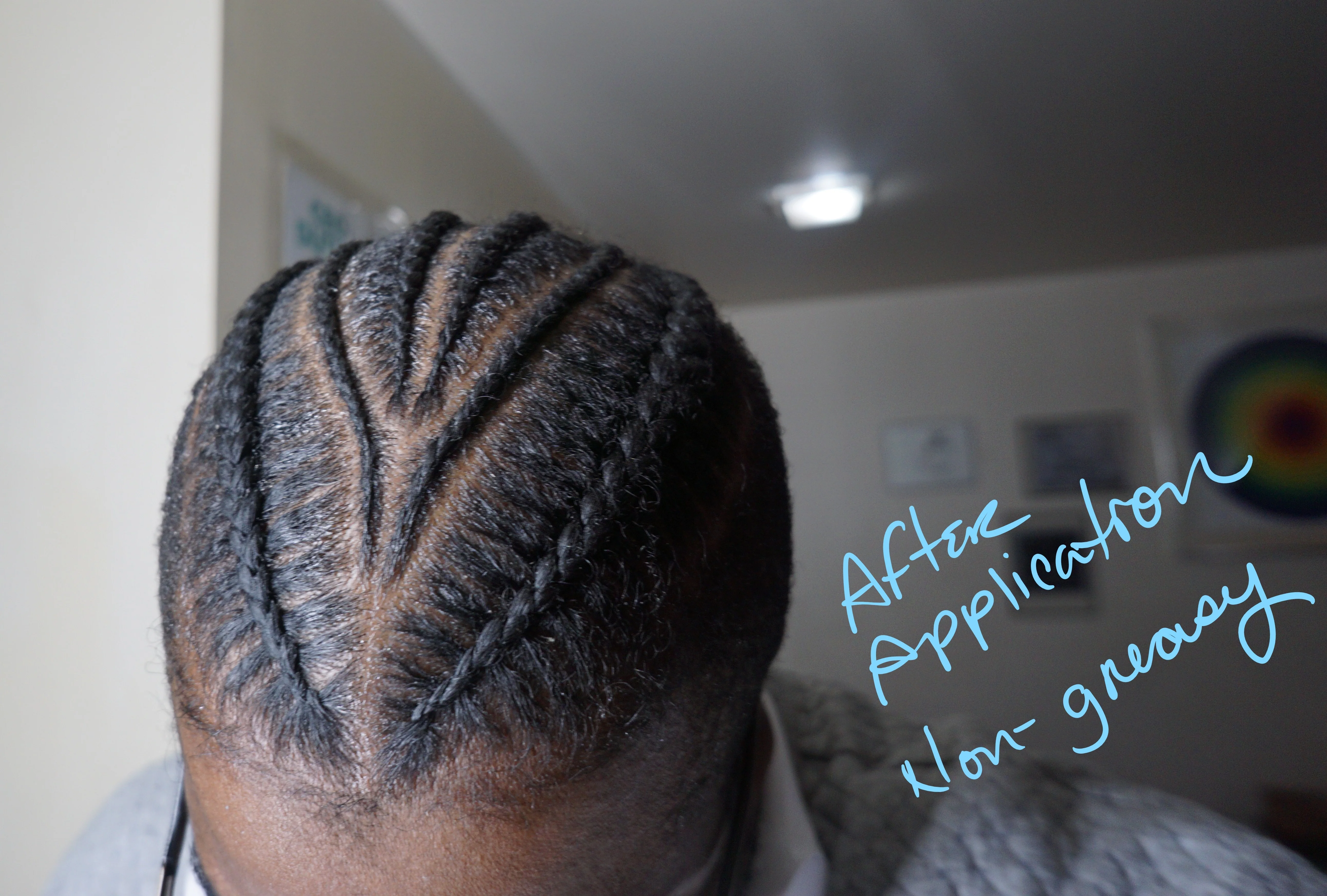 Anti-Itch Scalp Oil – Fast, Long-Lasting Relief for Dry, Flaky Scalps - Tea Tree 7% X Hempseed Oil - Image 6