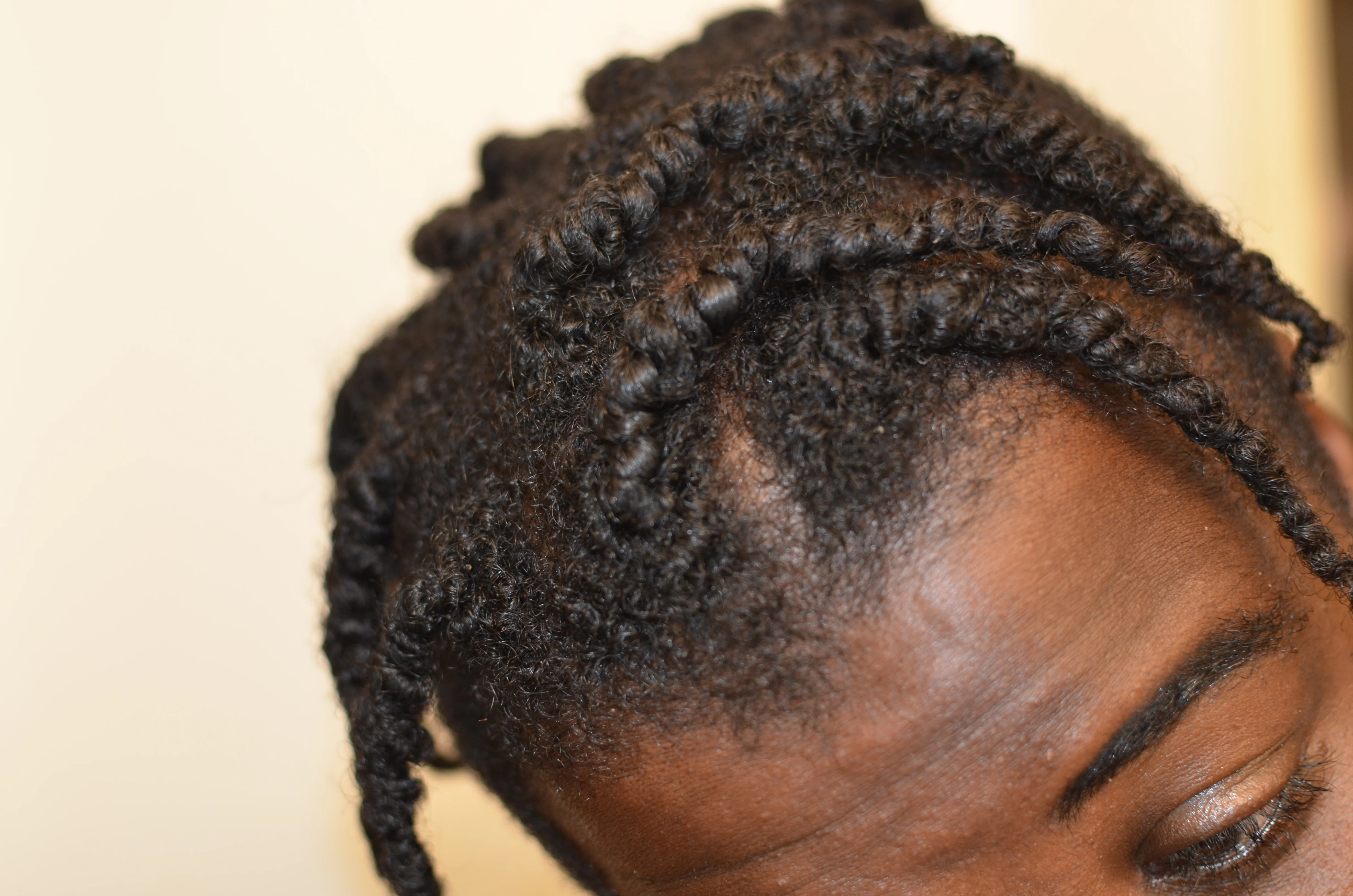Botanical Baldness π§β𦲠Buster w/ Stinging Nettles, Saw Palmetto, Rosemary | Hair Growth & Retention - Image 10