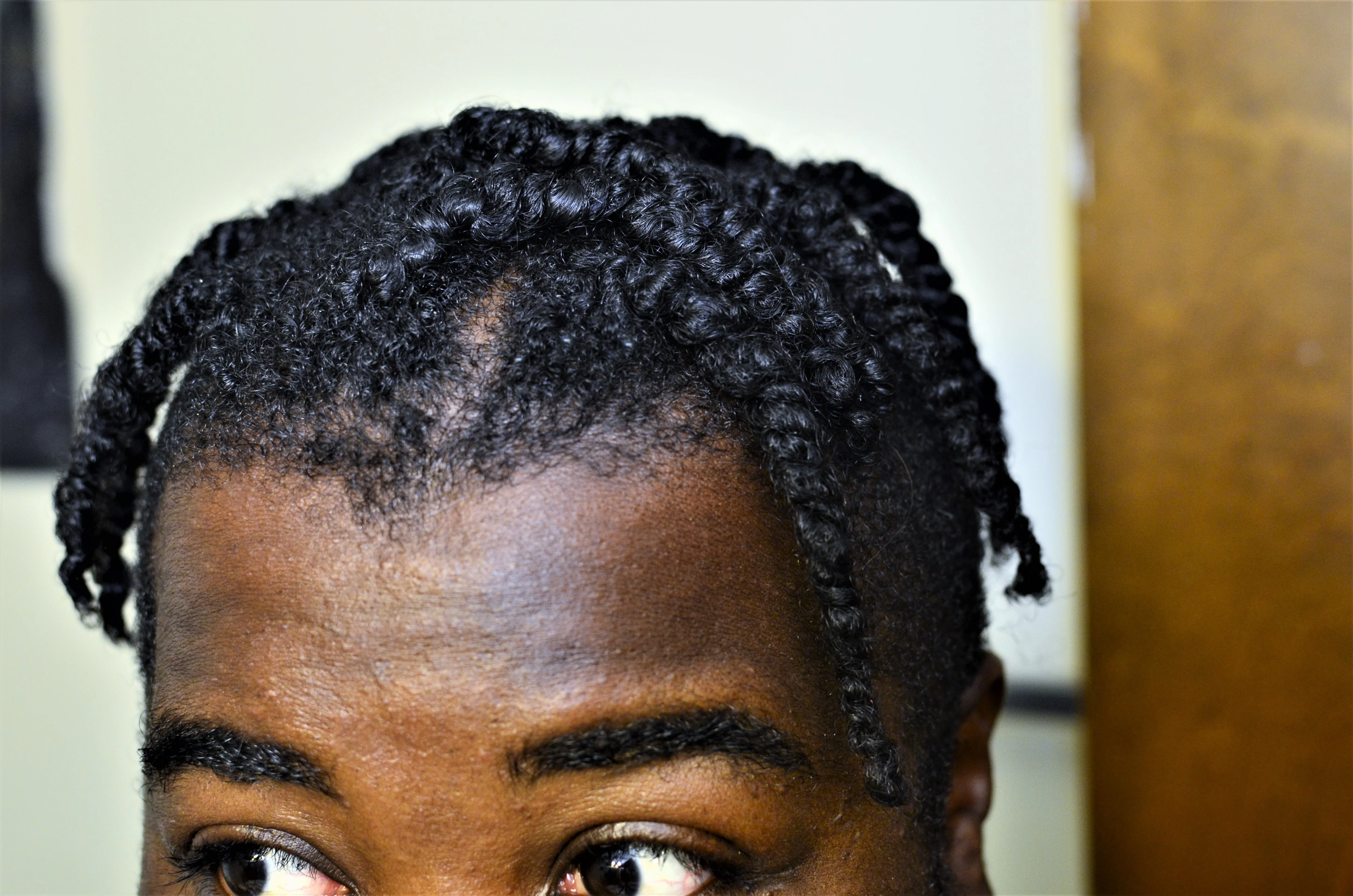 Botanical Baldness π§β𦲠Buster w/ Stinging Nettles, Saw Palmetto, Rosemary | Hair Growth & Retention - Image 7